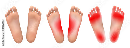 vector set of legs with red patches of pain on a white background