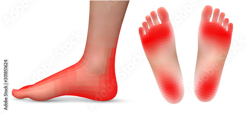 vector set of legs with red patches of pain on a white background