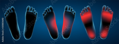 vector human foot. blue contour and red spots of pain. ready element for medicine and orthopedics