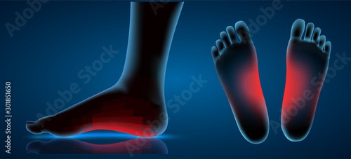 vector human foot. blue contour and red spots of pain. ready element for medicine and orthopedics