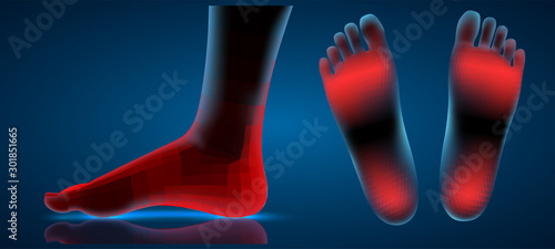vector human foot. blue contour and red spots of pain. ready element for medicine and orthopedics