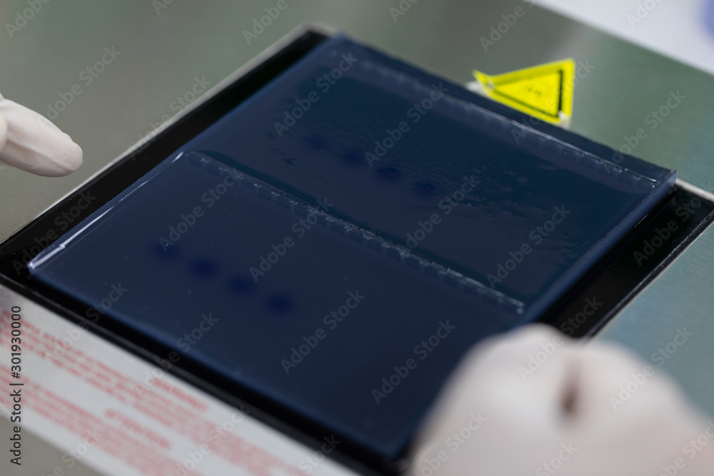 Polymerase Chain Reaction (PCR) and Agarose gel electrophoresis is a method of gel electrophoresis used in biochemistry, molecular biology, genetics, and clinical chemistry in lab. Polymerase Chain Reaction (PCR) and Agarose gel electrophoresis is a method of gel electrophoresis used in biochemistry, molecular biology, genetics, and clinical chemistry in lab.