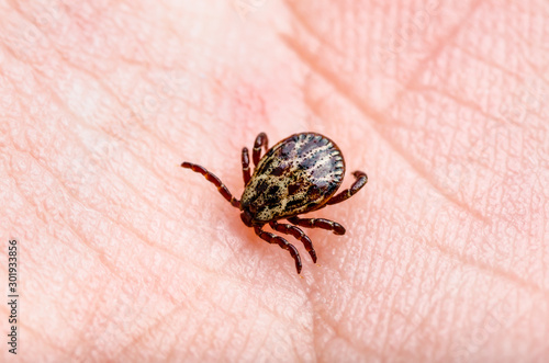 Lyme Disease Infected Tick Insect Skin Bite, Encephalitis Virus or Borreliosis Infectious Dermacentor Arachnid Parasite Macro © nechaevkon