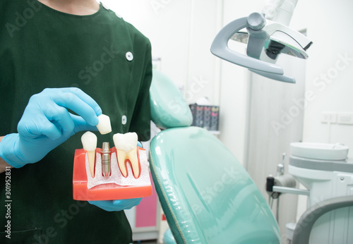 Wallpaper Mural Male dentist carrying a sample of dental implants. Torontodigital.ca