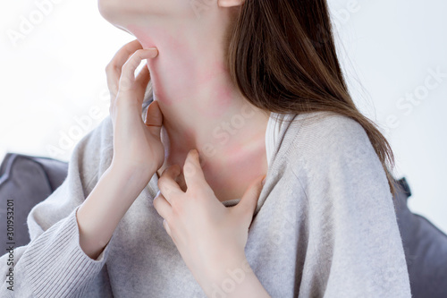 Closeup  girl is scratching her neck with nails. Reddened, inflamed body parts causes discomfort and itching. Young woman is suffering from bouts of allergies. Dermatological skin diseases concept. photo