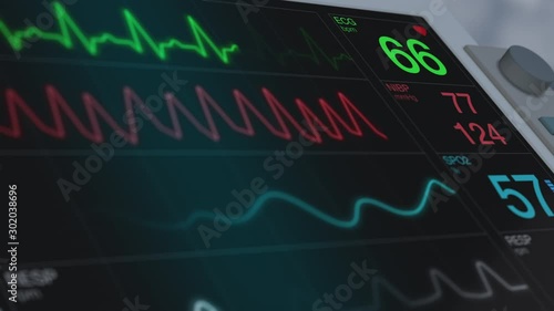 closeup view of an ecg ekg monitor on a operating room (3d render) photo