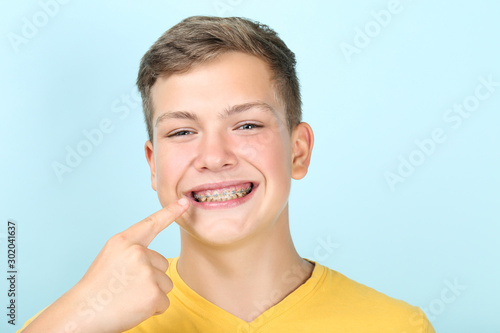 Young man pointing on dental braces on blue background