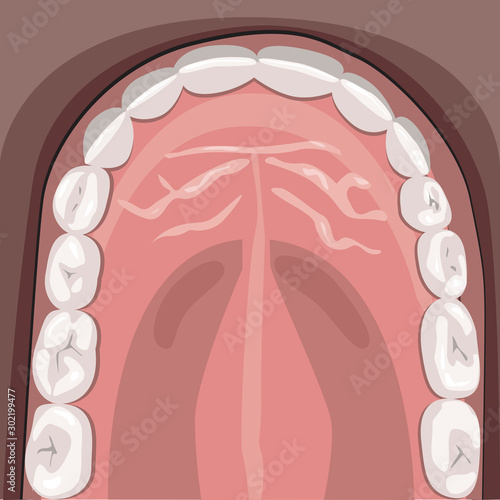 A upper jaw with molars, incisors and with white teeth after the dentist, a vector stock illustration