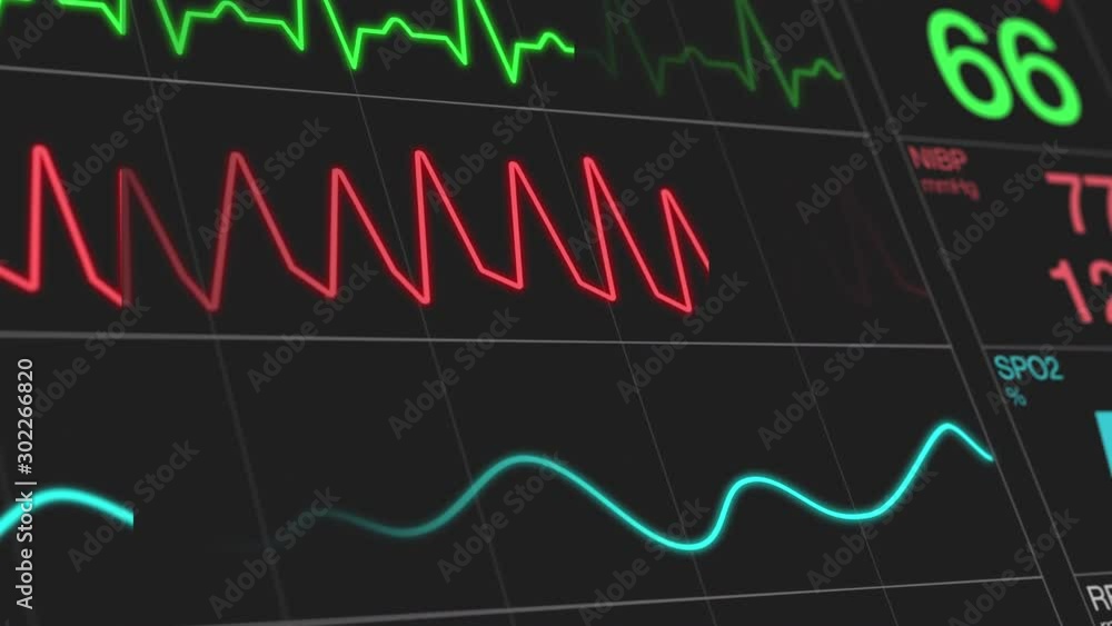 animation of an ecg ekg display (3d render)