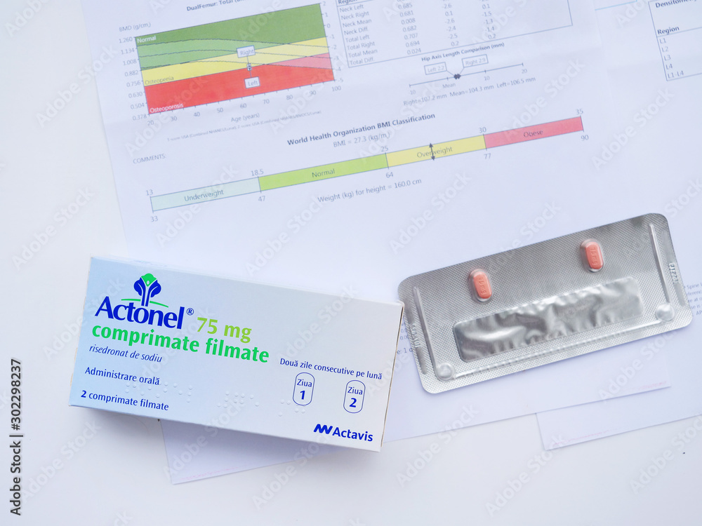 Actonel 75mg, risedronate sodium oral tablets. Twice a month bisphosphonate  drugs used to treat or prevent osteoporosis. Blurred DXA screaning results  in Cluj-Napoca, Romania on June 22, 2019 Stock Photo | Adobe Stock