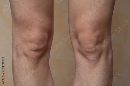Woman legs with knees on beige background