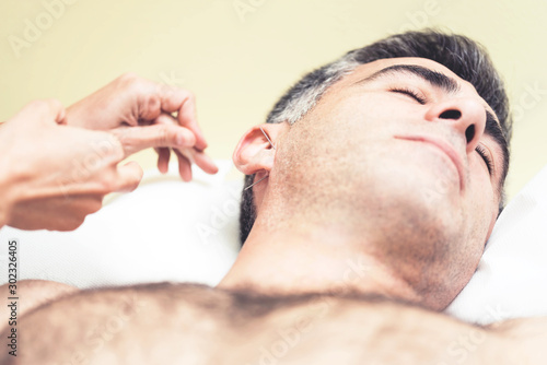Man on acupuncture