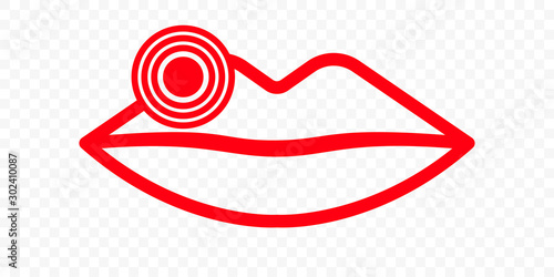 Lips herpes vector icon. Lip cold sore herpes simplex virus, labial infection inflammation symbol for medicine treatment or lipstick package, simple line design
