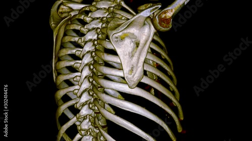 A 3D CT scan of the bones of a male torso, realistic 3D reconstruction. Medical concept, animation loop. photo