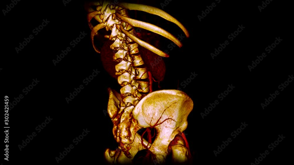Skeleton scanning In 3D Mri scan. CT Scan Hip and Spine Area 3D in the Computer Screen. Seamless Loop animation. Medical concept Skeleton scanning In 3D Mri scan. CT Scan Hip and Spine Area 3D in the Computer Screen. Seamless Loop animation. Medical concept