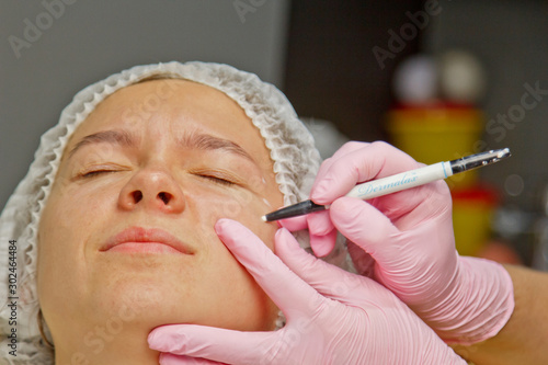 Attractive girl patient with instructions on her face for plastic surgery operation. Surgeon touching a person's face. The concept of aesthetic cosmetology and injection. photo