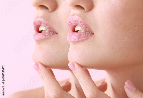 Photo Young woman before and after lip enhancement on color background, closeup