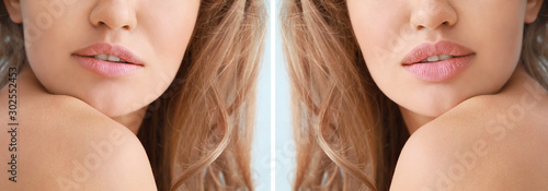 Young woman before and afte...