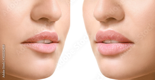 Young woman before and afte...