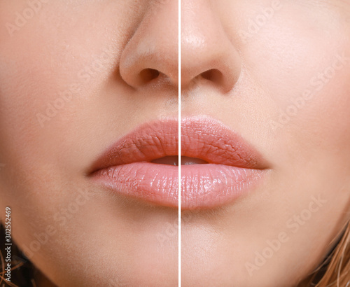 Young woman before and afte...