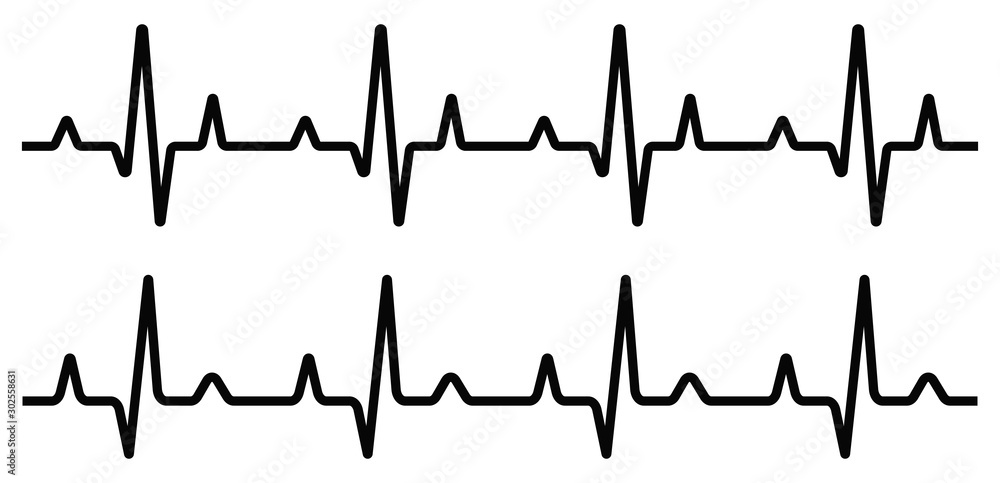 Heartbeat line set. EKG. Vector