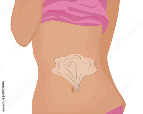 Bloating and excess gas in stomach or intestine vector illustration