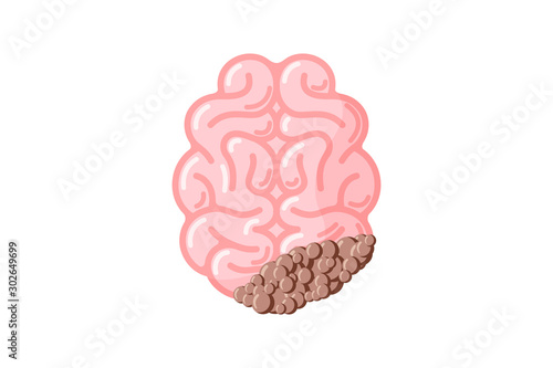 Human brain with cancer tumor. Sick suffering damage central nervous system organ. Vector illustration