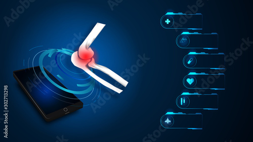 Medical orthopedic and the future of the smart hospital. Treatment for orthopedics traumatology of elbow bones and joints injury. Medical presentation, hospital. Vector illustration