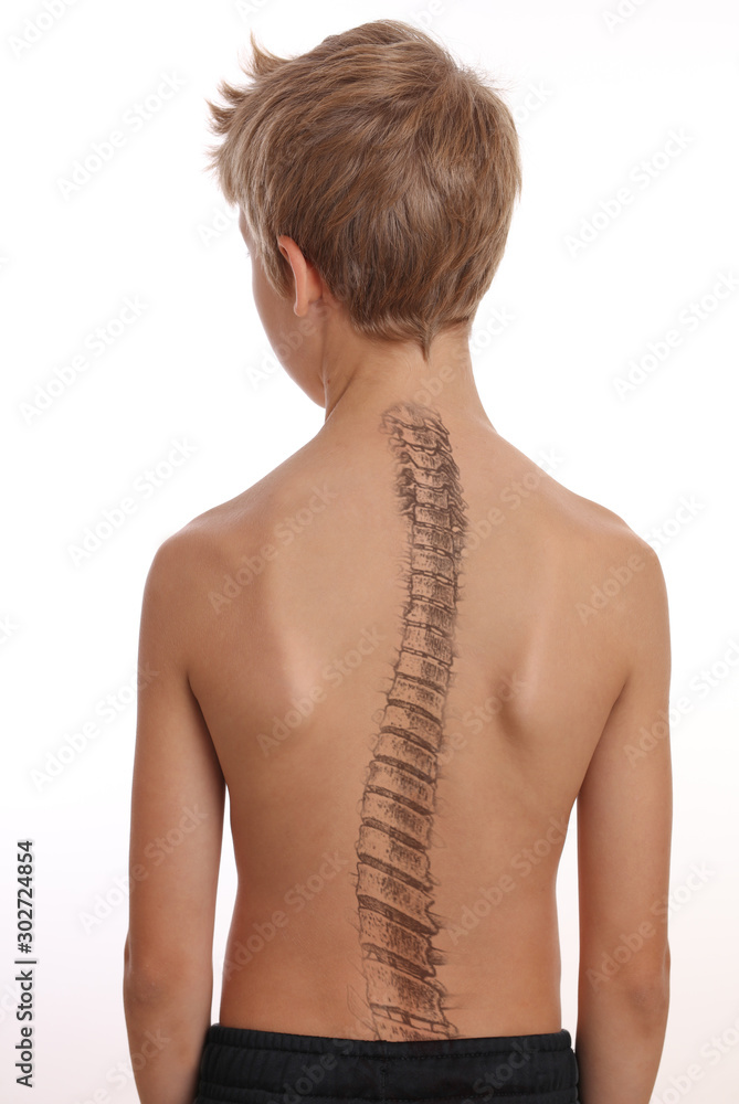 Relieve Lumbar Spine Pain  Spine Correction Center of the Rockies