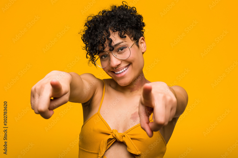 Young african american woman with skin birth mark cheerful smiles pointing to front.