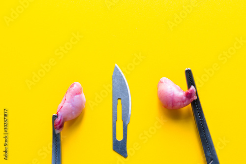 close-up photo of a surgical blade and two testicles of a dog trapped in forceps photo