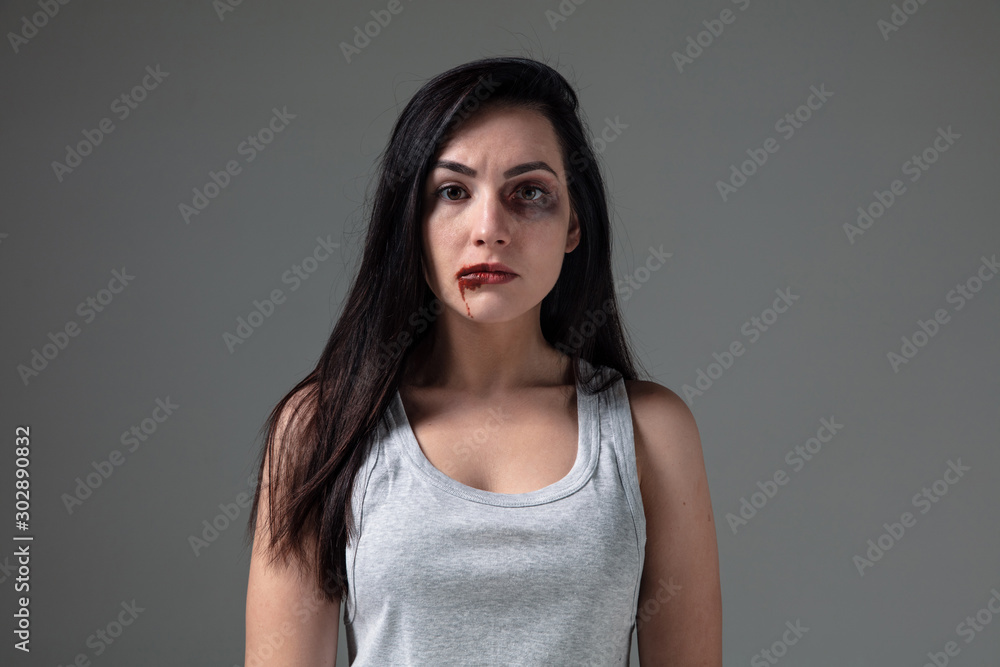 Woman in fear of domestic abuse and violence, concept of female rights. Caucasian brunette woman on grey background looks upset, sad, depressed being victim of man or husband. Has bruises, hematomas. Woman in fear of domestic abuse and violence, concept of female rights. Caucasian brunette woman on grey background looks upset, sad, depressed being victim of man or husband. Has bruises, hematomas.