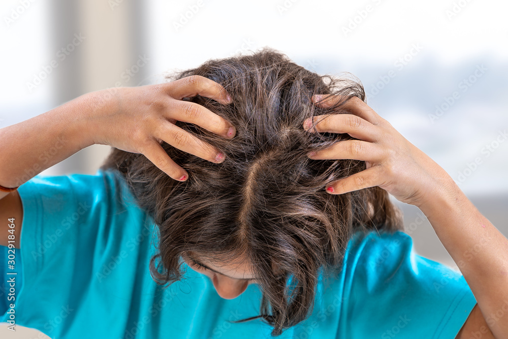 Fototapeta premium Mad Child , because lice on the head,she is symptoms itching-school season concept