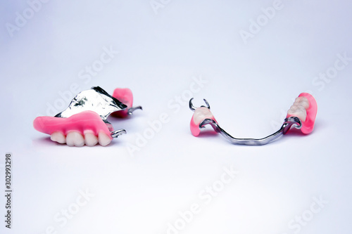 dentures with crowns. dental prosthetics. dentistry. replacement of missing teeth. metal prostheses. set of false teeth photo