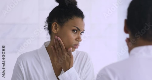 Worried african lady upset with dry skin looking in mirror photo