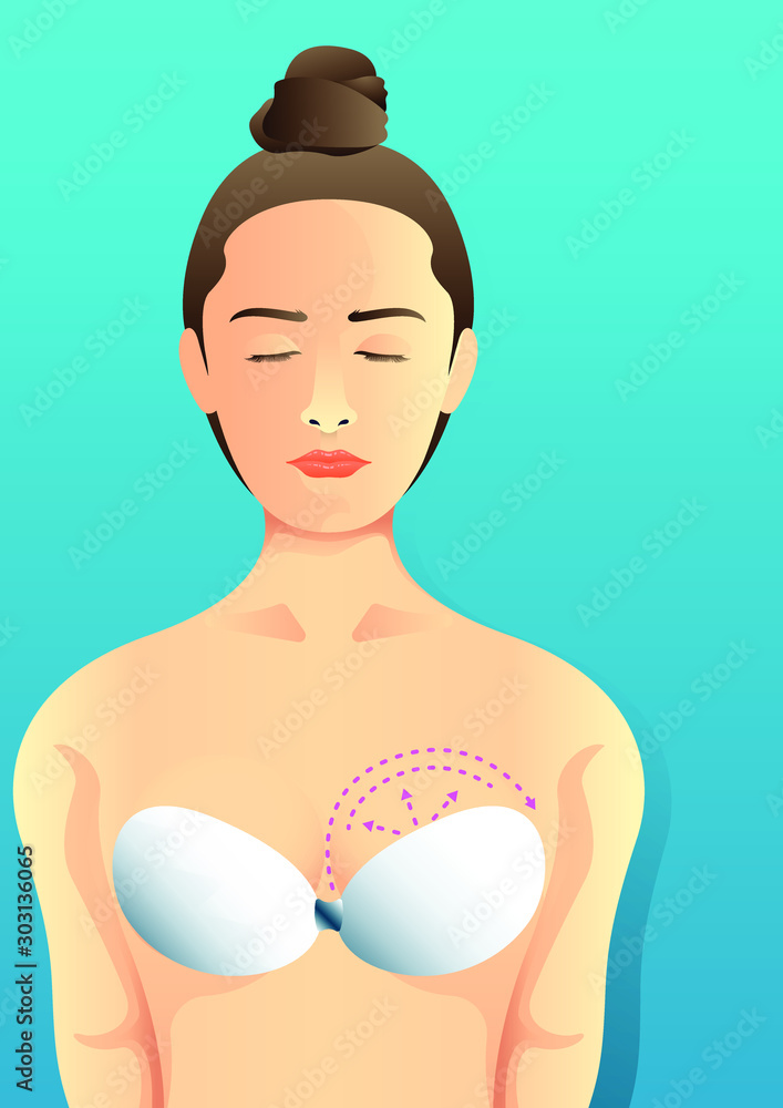 stock vector of woman with dotted line on breast. front view women chest.  describe of plastic surgery, surgical cosmetic procedure. for advertising  and medical publications. Stock Vector