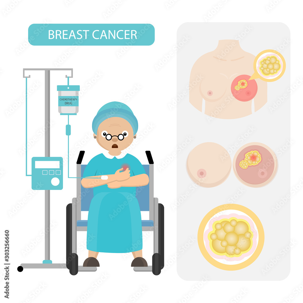 Senior woman with Breast Cancer in cartoon style Senior woman with Breast Cancer in cartoon style