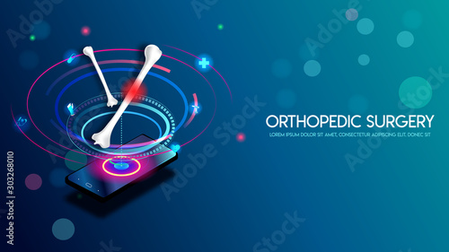 Medical orthopedic and the future of the smart hospital. Treatment for orthopedics traumatology of humerus bone and joints injury. Medical presentation, hospital. Vector illustration