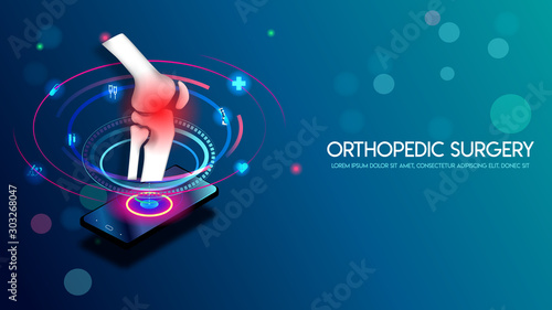 Medical orthopedic and the future of the smart hospital. Treatment for orthopedics traumatology of knee bones and joints injury. Medical presentation, hospital. Vector illustration