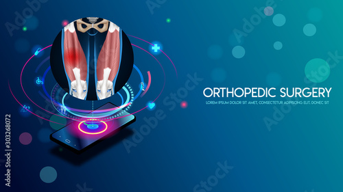 Medical orthopedic and the future of the smart hospital. Treatment for orthopedics traumatology of quadriceps muscle and joints injury. Medical presentation, hospital. Vector illustration