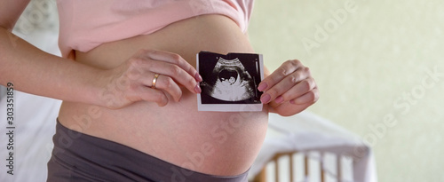 Big pregnant tummy and woman's hands holding ultrasound image of healthy unborn baby. Women's health and people concept. Maternity prenatal care and woman pregnancy concept. Panoramic banner. photo