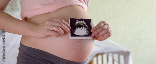 Tableau sur toile Big pregnant tummy and woman's hands holding ultrasound image of healthy unborn baby