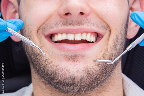 mouth closeup with dentist tools