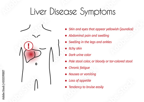 Vector Liver Disease Symptoms Infographic of Young Man