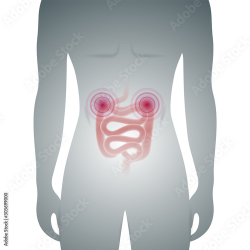 Abstract medical vector illustration of male silhouette with intestine inflammation