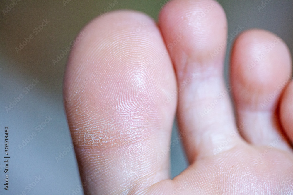 young girl's toes are healthy and beautiful. young girl's toes are healthy and beautiful.