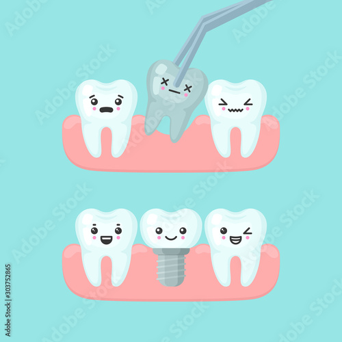 Tooth extraction and implantation stomatology concept. Cute cartoon vector teeth implant isolated illustration