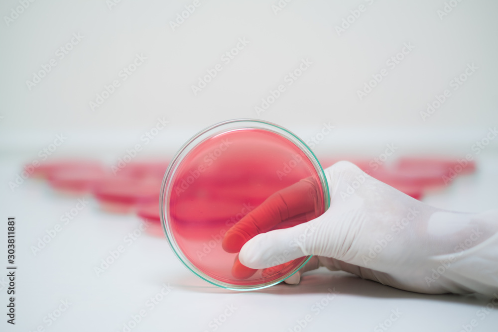 Ταπετσαρία Red agar media plate handle by hand with sterile gloves in the background of aga