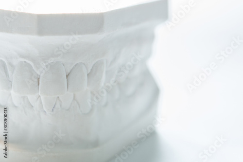 Bild auf Leinwand Gypsum model of human jaw on a white background.