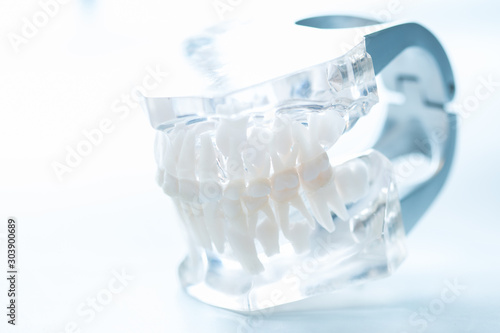 Dental model